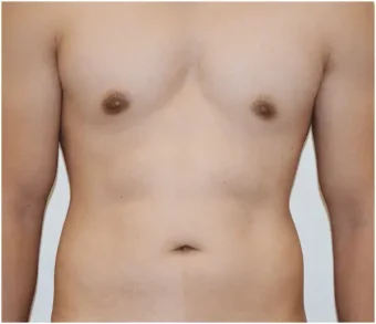 pic-432x501-result-2-before